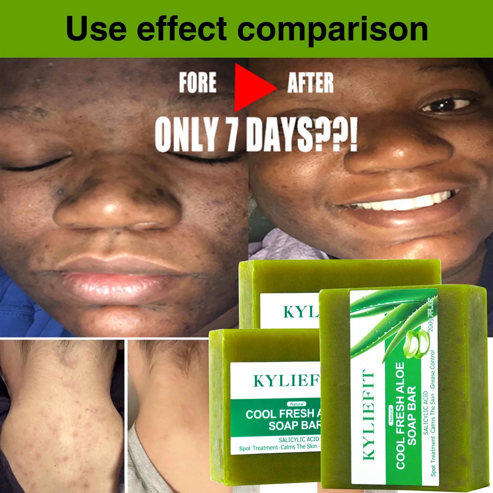 AILKE Aloe Vera Whitening Soap, Remove Acne, Spots, Skin Radiant, Improve Skin Luster, Vegan Bath Wash for All Skin Types, 200g